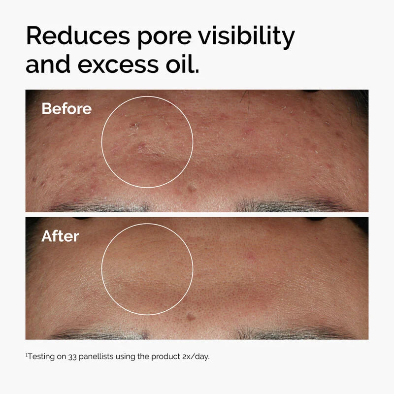 Niacinamide 10% + Zinc 1% Oil Control Serum