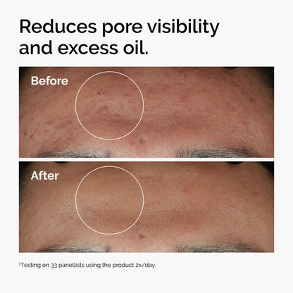 Niacinamide 10% + Zinc 1% Oil Control Serum